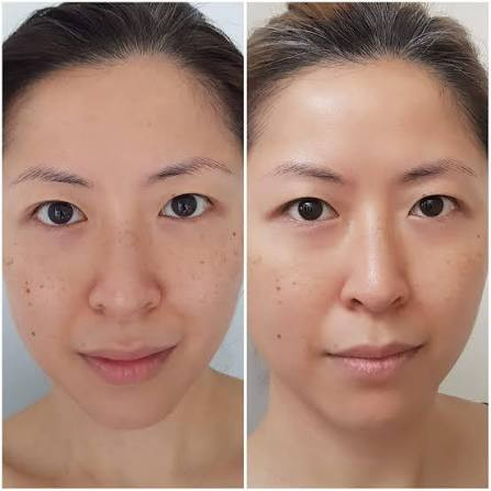اسنس لایه بردار و شفاف کننده مینی لنکوم اورجینال